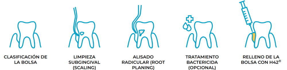 innovador hidrogel a base de colágeno